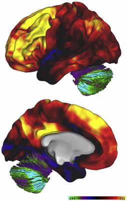 Stuttering: A Disorder of Energy Supply to Neurons?